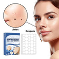 Pegatina para eliminar verrugas y lunares